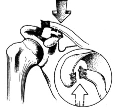 Grade 4 Dislocation